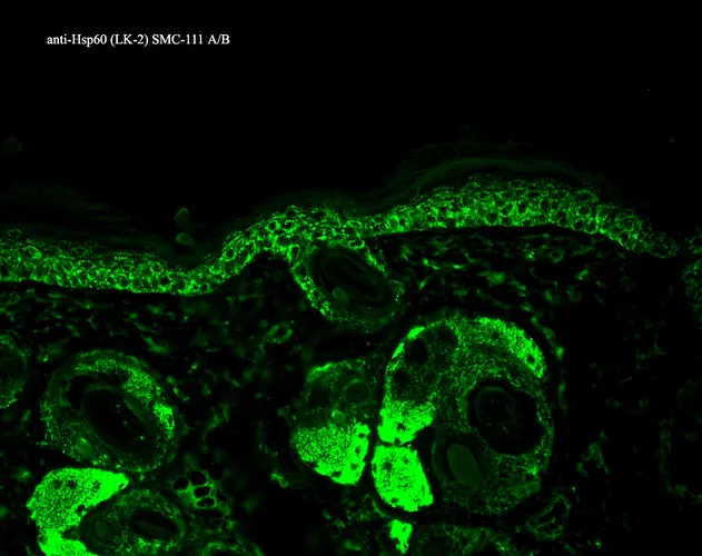 HSP60 Antibody - image 2