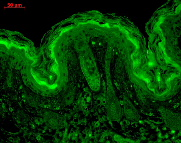 CaMKII (Alpha-Specific) Antibody: PerCP - image 3
