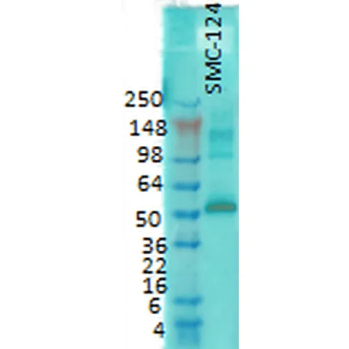 CaMKII (Alpha-Specific) Antibody - image 2
