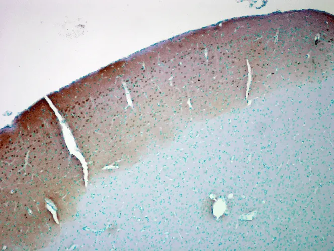 CaMKII (Alpha-Specific) Antibody - image 4