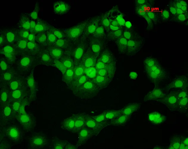 CaMKII (Alpha-Specific) Antibody - image 1