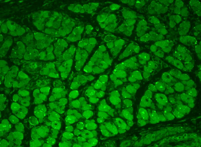 CaMKII Antibody - image 2