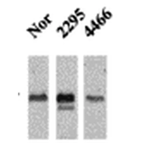 CaMKII Antibody - image 4