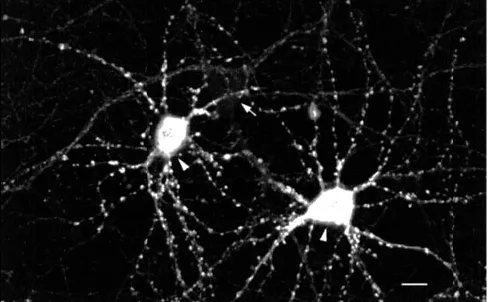 CaMKII Antibody - image 1