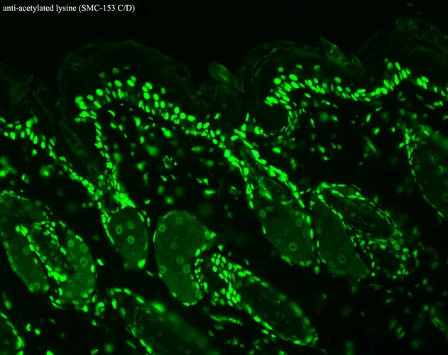 Acetylated Lysine Antibody - image 1