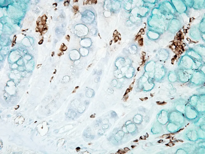 DNA/RNA Damage Antibody: APC - image 2