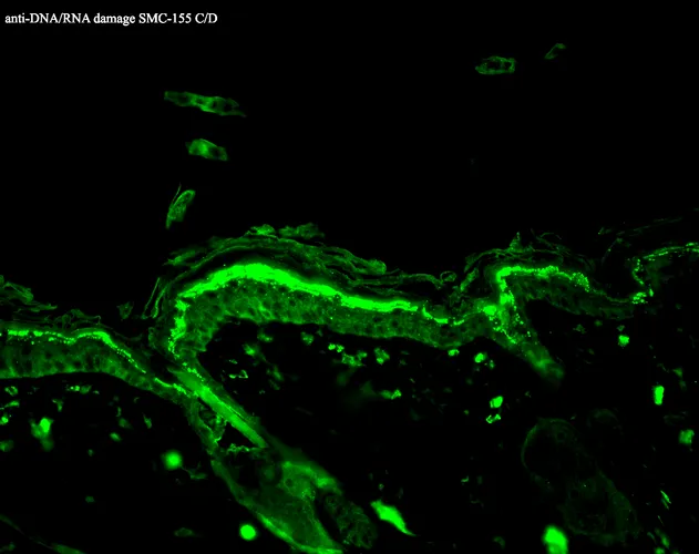 DNA/RNA Damage Antibody: APC - image 3