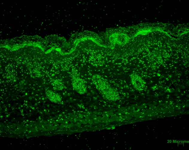 ERp57 (GRP58) Antibody - image 2