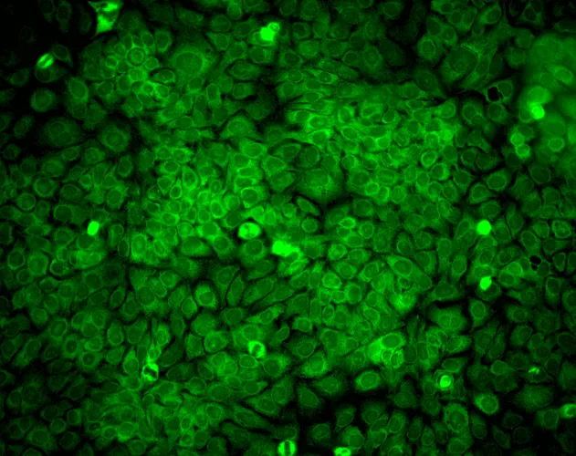 ERp57 (GRP58) Antibody - image 4