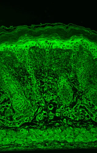HIF1 alpha Antibody - image 1