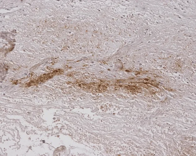 Alginate Antibody - image 1