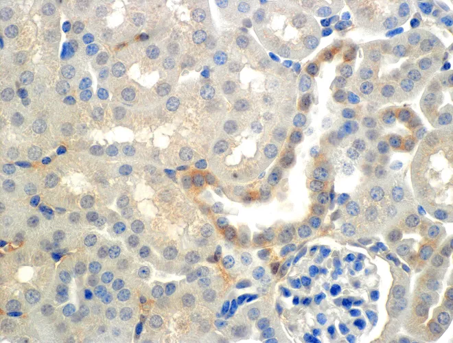 ENaC beta Antibody: APC - image 1