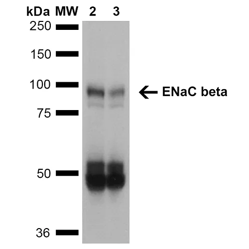 ENaC beta Antibody: PerCP - image 2