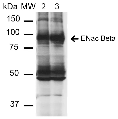 ENaC beta Antibody: PerCP - image 1