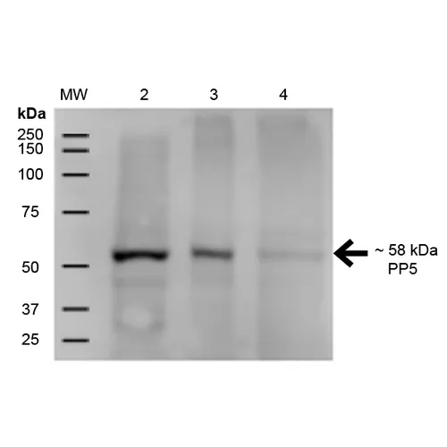 PP5 Antibody - image 3