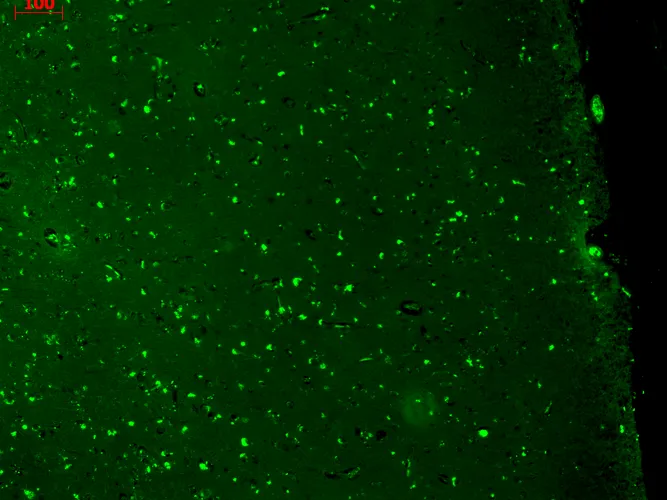 KCNQ1 Antibody: APC - image 2