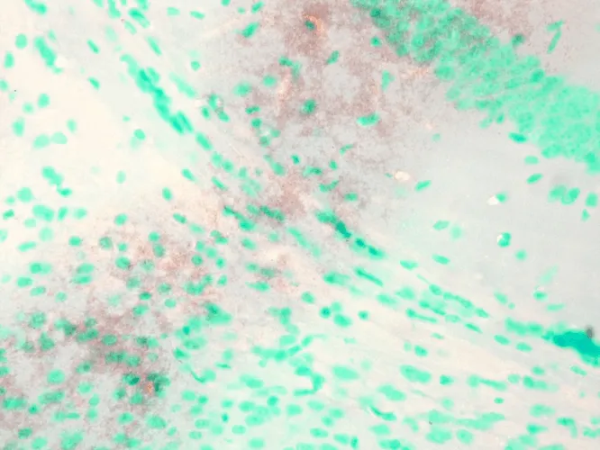 KCNQ1 Antibody: APC - image 4