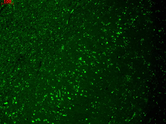 HCN4 Antibody - image 4