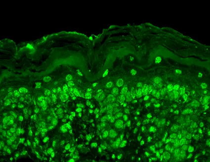 Cav beta 2 Antibody: PerCP - image 2