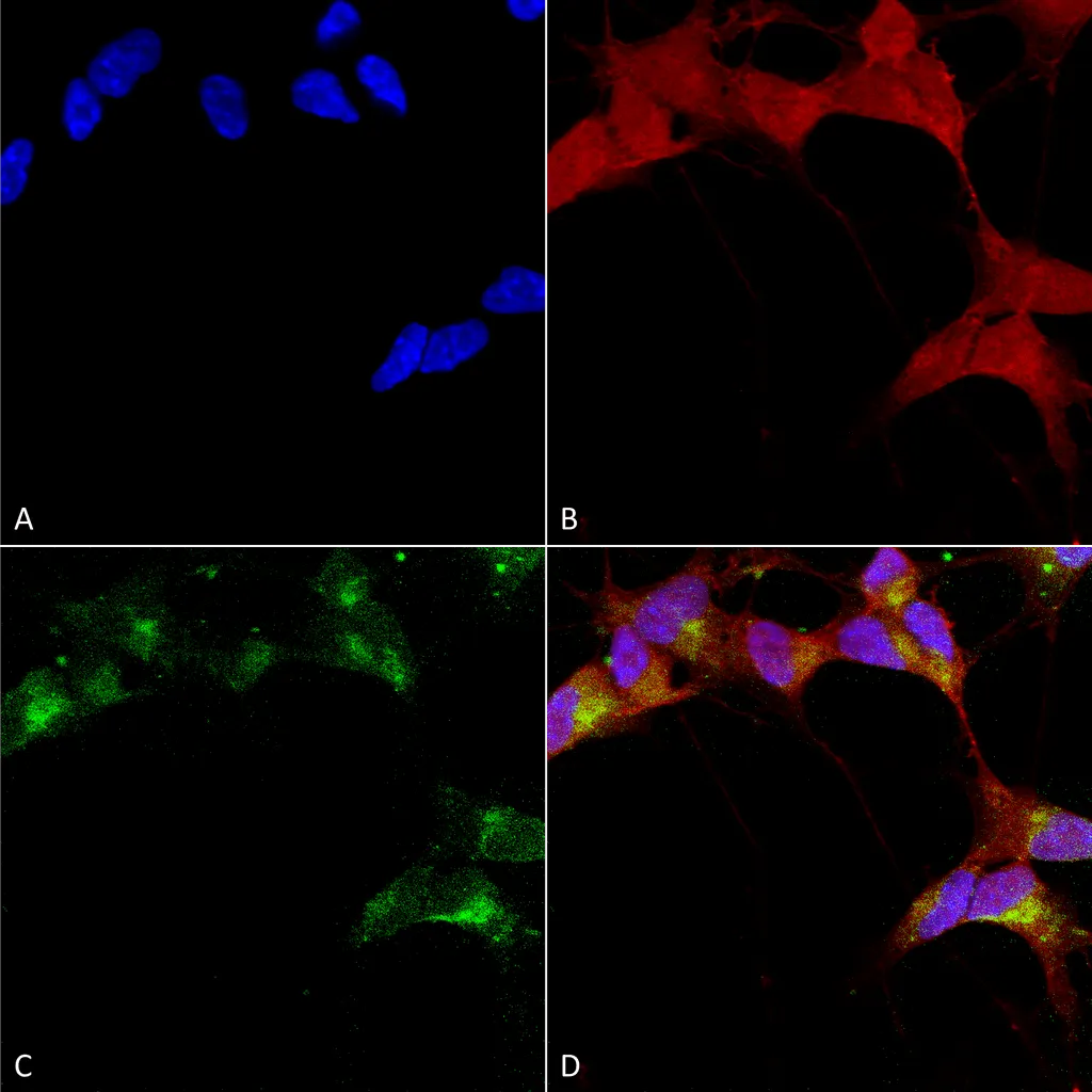 GABA-A Receptor Beta 3 Antibody - image 1