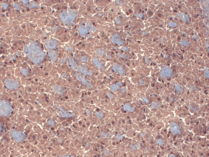 GABA-A Receptor Beta 3 Antibody: Biotin - image 2