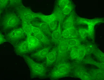 GABA-A Receptor Delta Antibody - image 2