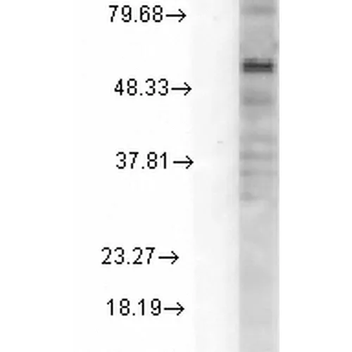 GABA-A Receptor Delta Antibody - image 3