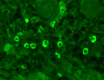 GABA-A Receptor Alpha-1 Antibody: PerCP - image 2