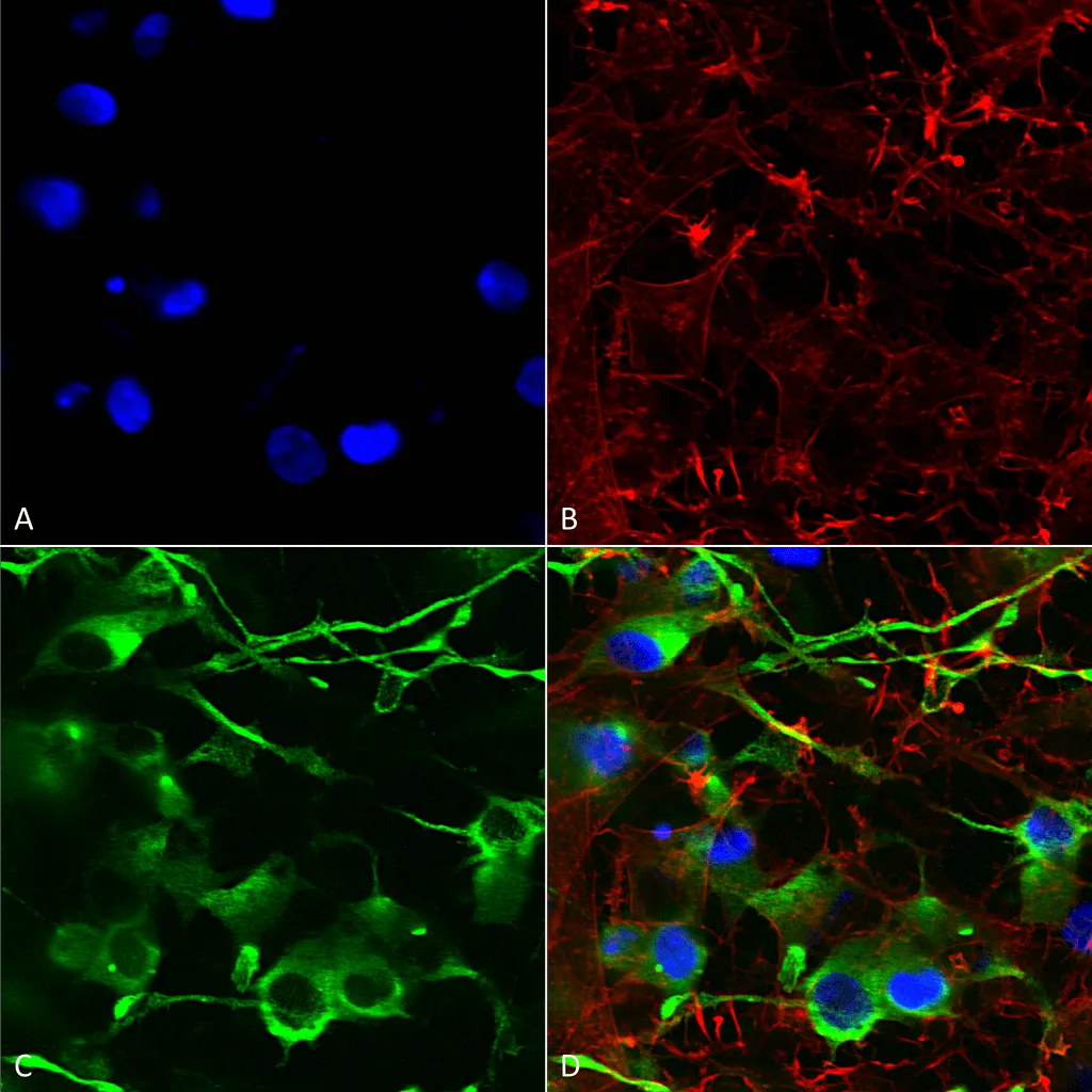 KCC2 Antibody: RPE - image 1