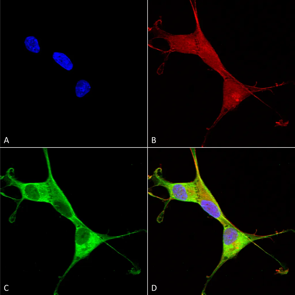 Copper Transporting ATPase 1 Antibody - image 1