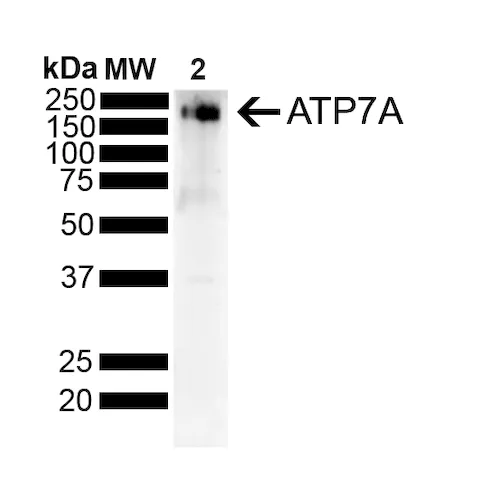 Copper Transporting ATPase 1 Antibody - image 2