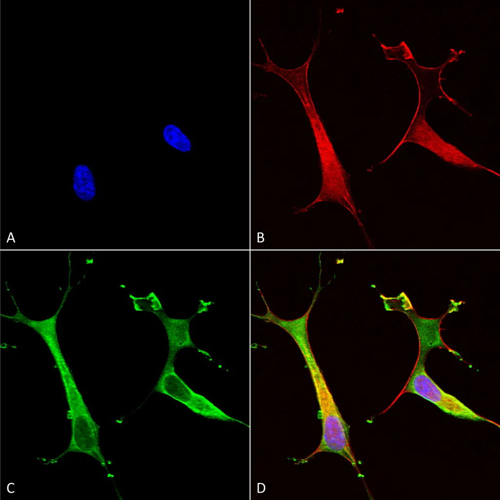 Copper Transporting ATPase 2 Antibody - image 1