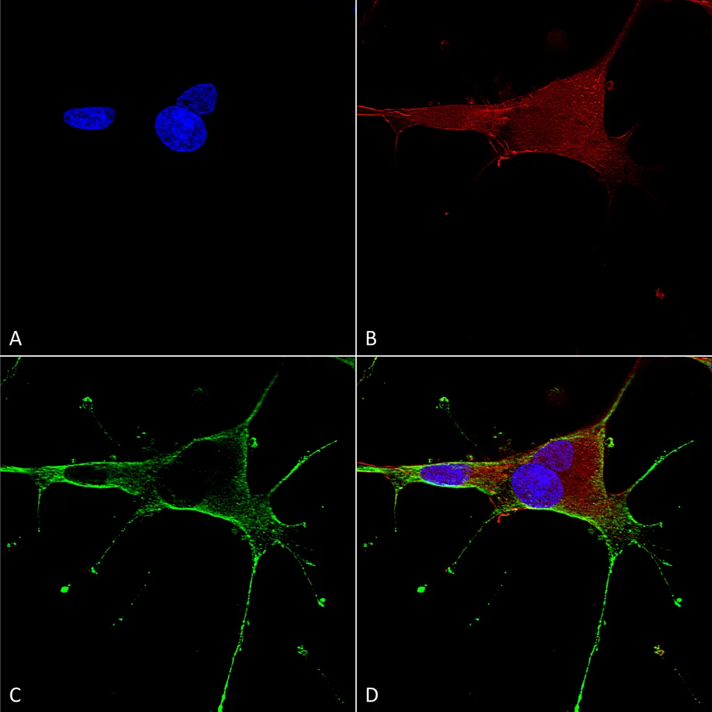 GluN1/NR1 Antibody - image 1
