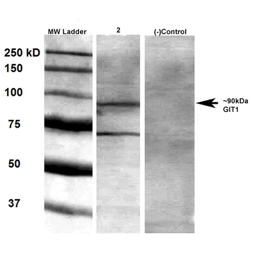 GIT1 Antibody - image 2