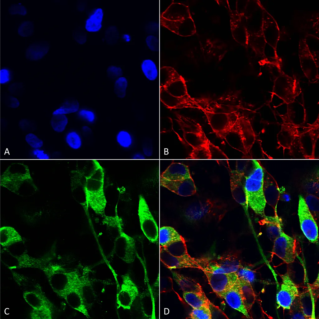 Versican Antibody: RPE - image 1