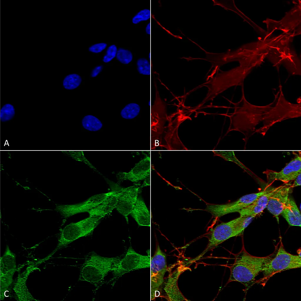 LRRK2/Dardarin Antibody - image 1