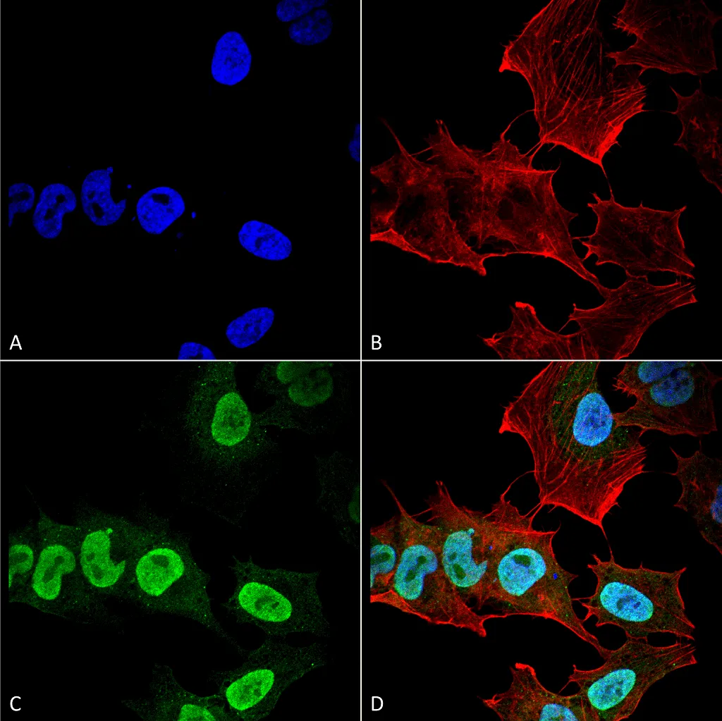 Alpha Synuclein Antibody - image 1