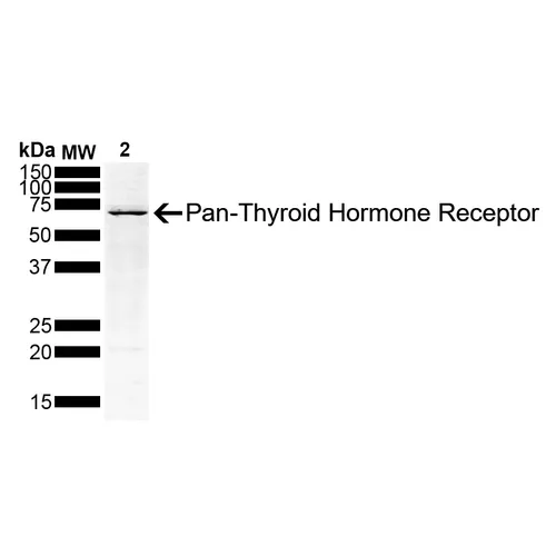 Thyroid Hormone Receptor Antibody - image 4