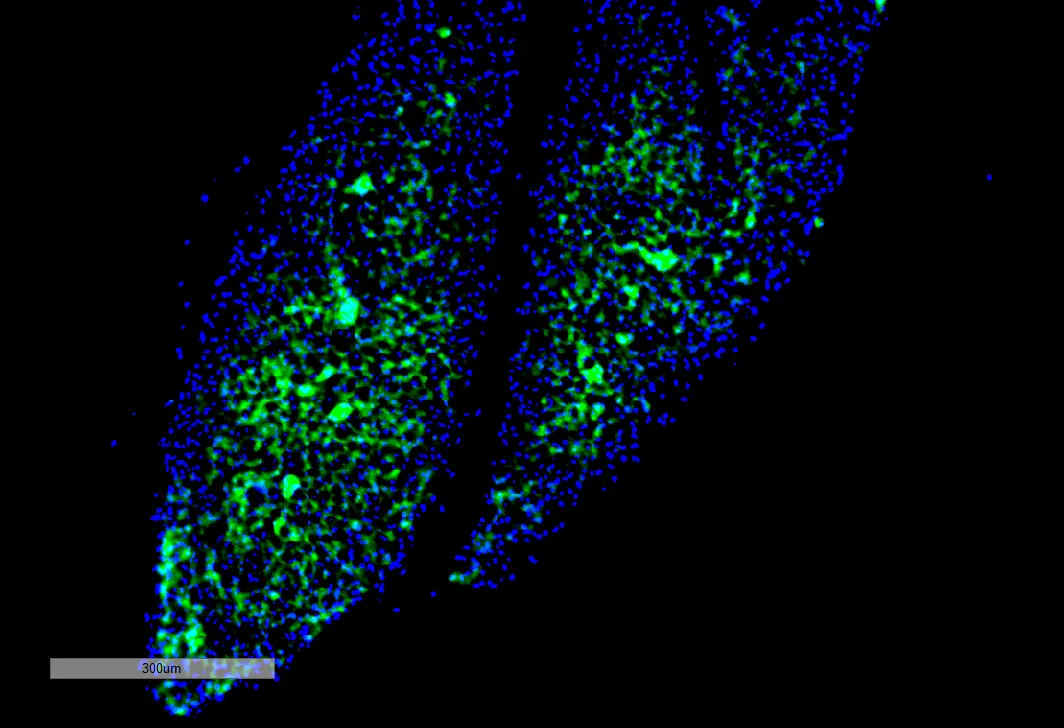 Thyroid Hormone Receptor Antibody - image 1