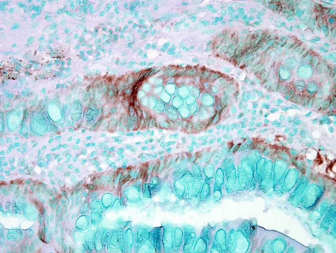 HSP70 Antibody - image 2