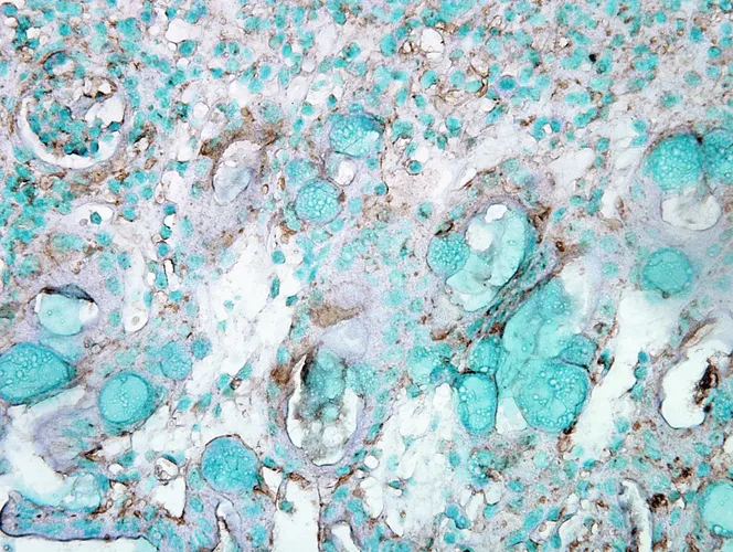 HSP70 Antibody - image 7