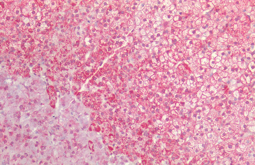 HSP60 Antibody - image 2