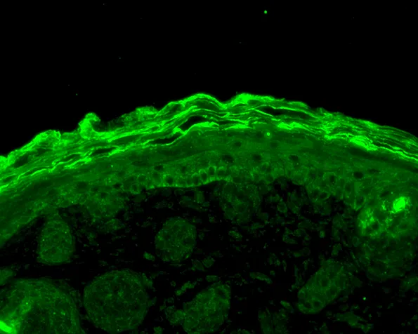 Calnexin-NT Antibody: Biotin - image 3