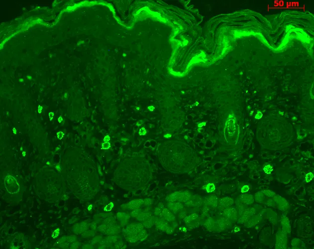 TNF-R1 Antibody - image 2