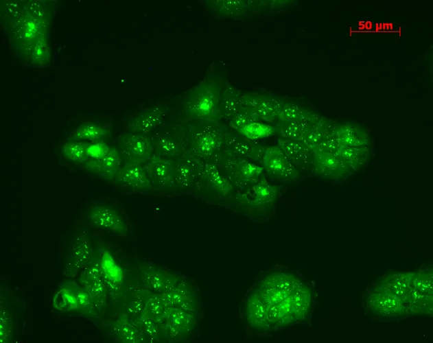 TNF-R1 Antibody - image 4