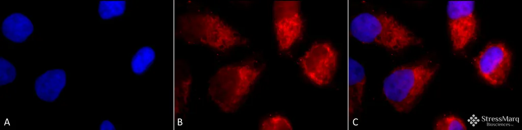 TNF-R1 Antibody - image 1