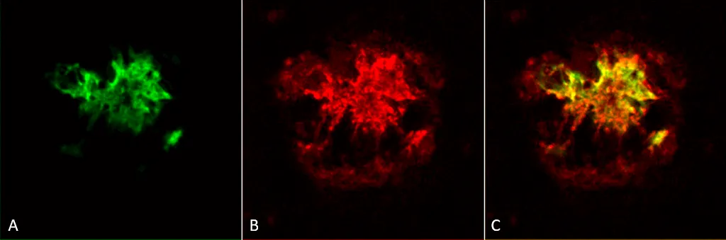 Amyloid Oligomers (A11) Antibody - image 1