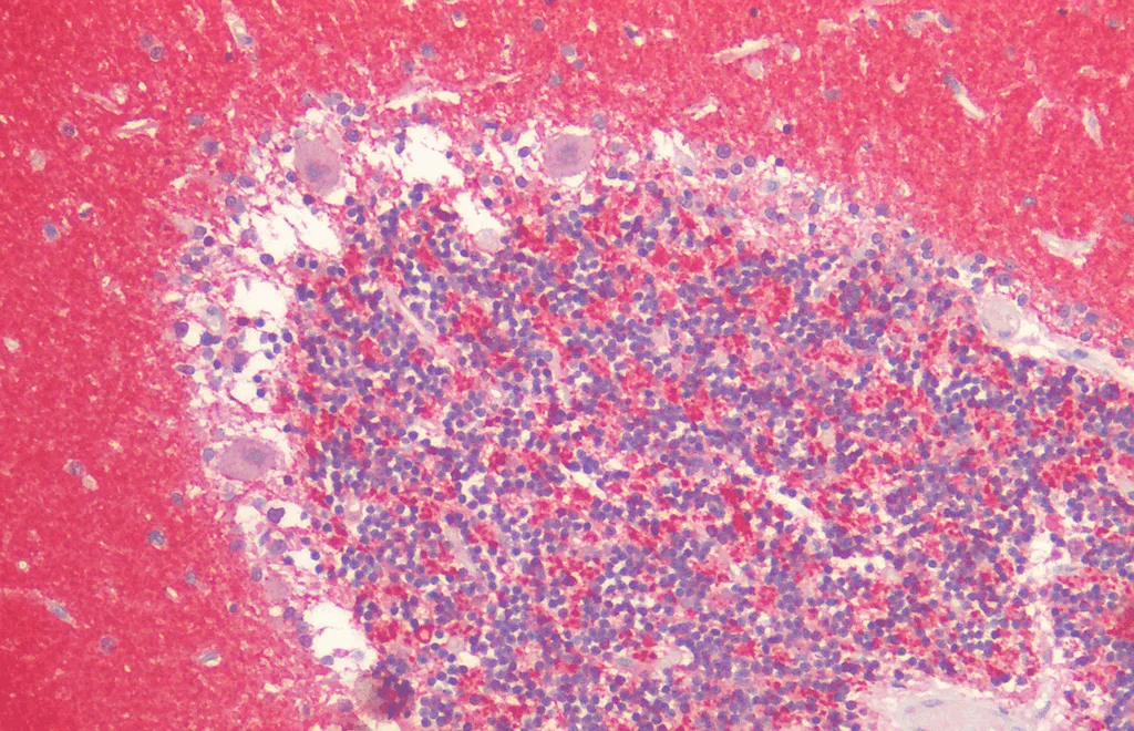 Alpha Synuclein Antibody - image 1