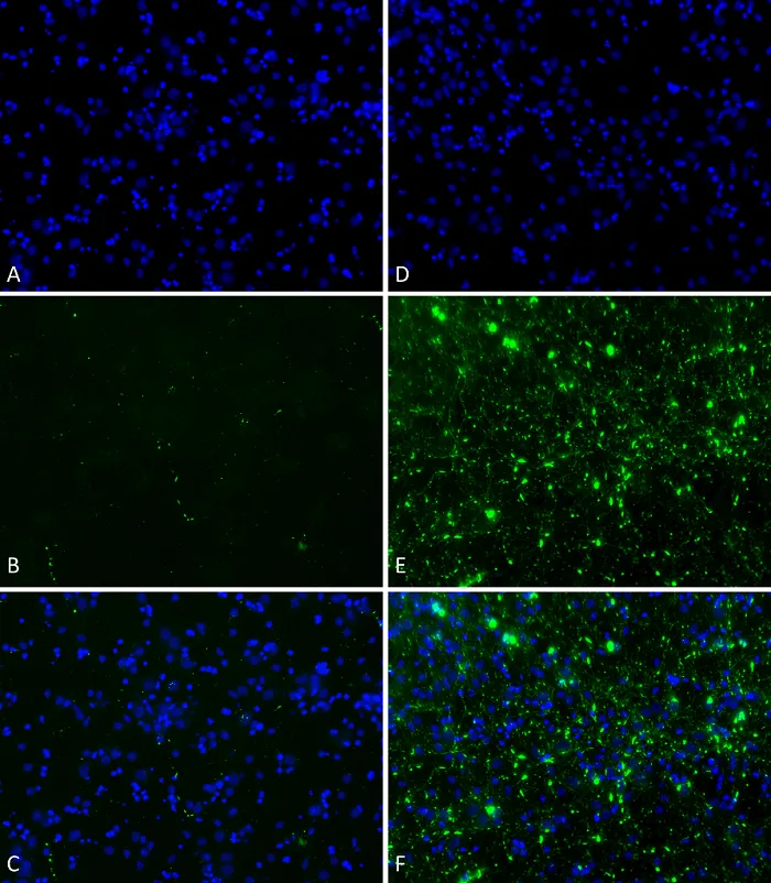 Alpha Synuclein Pre-formed Fibrils (Type 2) - image 2