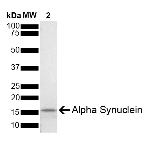 Alpha Synuclein Monomers (Type 1) - image 3